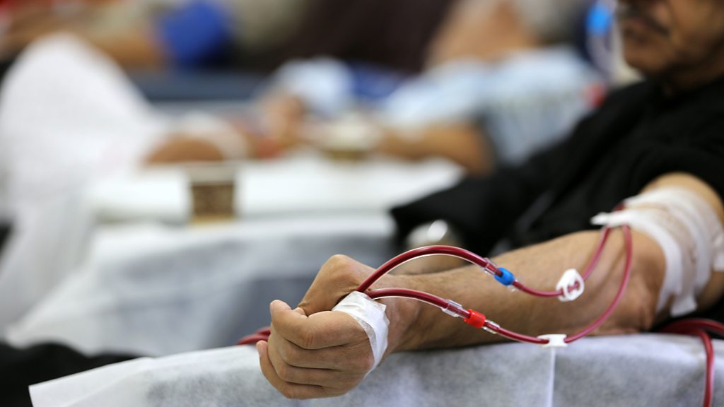 تحذيرات من وفاة 240 مريضاً إثر توقف نصف أجهزة غسيل الكلى بمجمع الشفاء